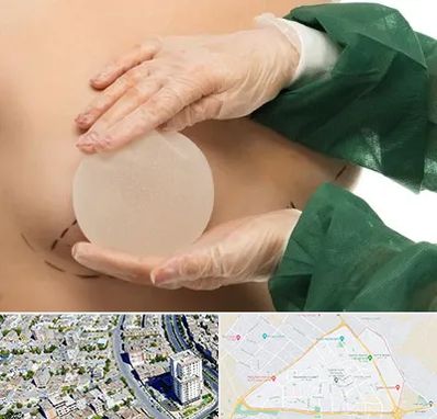 جراحی پروتز سینه در قاسم آباد مشهد