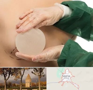 جراحی پروتز سینه در تویسرکان
