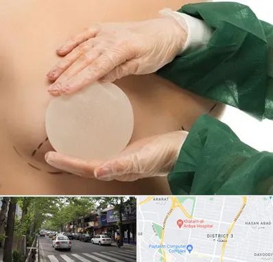 جراحی پروتز سینه در ظفر