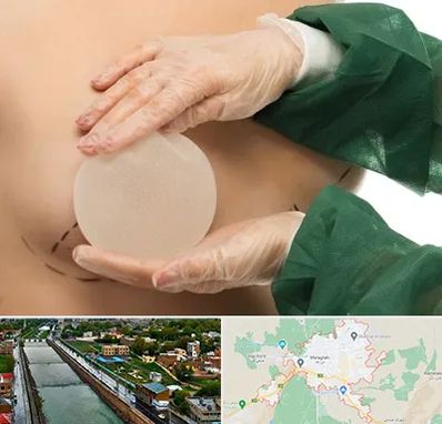 جراحی پروتز سینه در مراغه