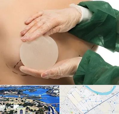 جراحی پروتز سینه در کوروش اهواز