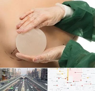 جراحی پروتز سینه در توحید