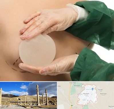 جراحی پروتز سینه در مرودشت