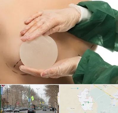 جراحی پروتز سینه در نظرآباد کرج