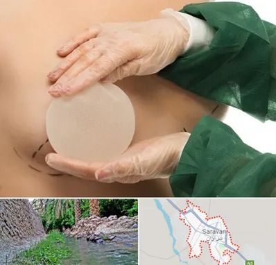 جراحی پروتز سینه در سراوان