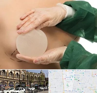 جراحی پروتز سینه در منطقه 11 تهران