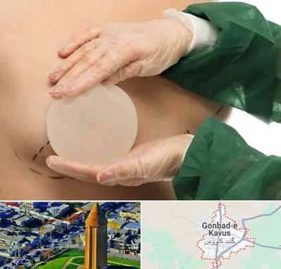 جراحی پروتز سینه در گنبد کاووس