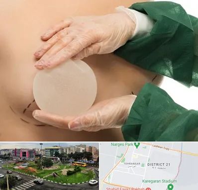 جراحی پروتز سینه در تهرانسر