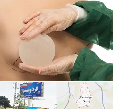 جراحی پروتز سینه در فردوسیه شهریار