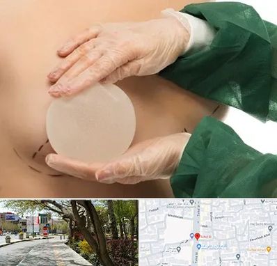 جراحی پروتز سینه در خیابان توحید اصفهان