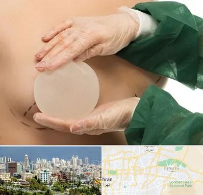 جراحی پروتز سینه در شرق تهران