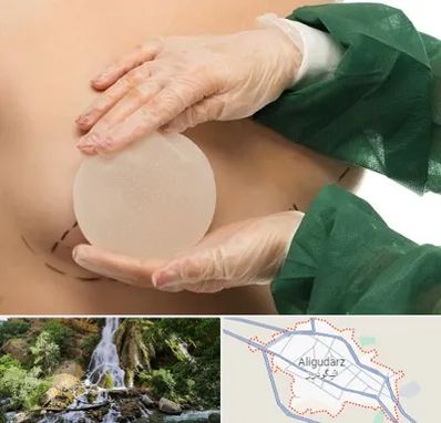 جراحی پروتز سینه در الیگودرز