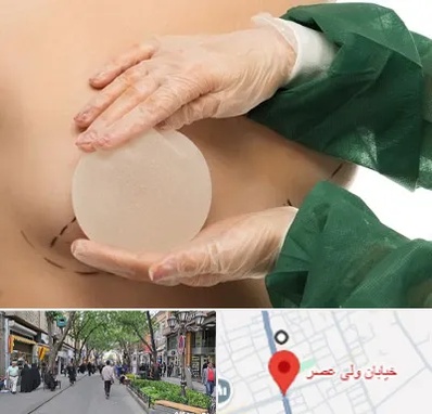 جراحی پروتز سینه در ولیعصر شهریار