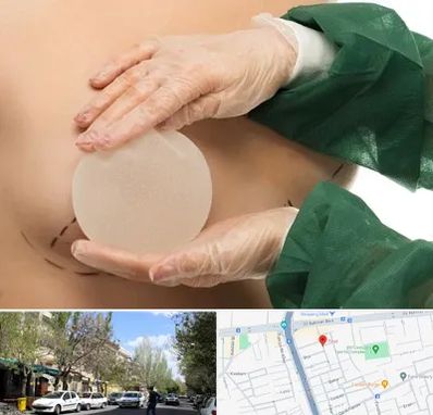 جراحی پروتز سینه در کوی فیروز تبریز