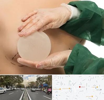 جراحی پروتز سینه در دولت