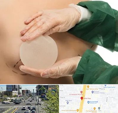 جراحی پروتز سینه در ستاری