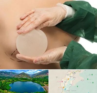 جراحی پروتز سینه در رودبار