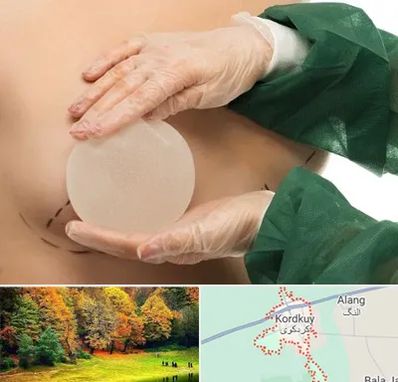 جراحی پروتز سینه در کردکوی
