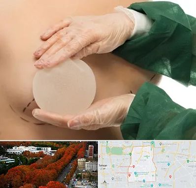 جراحی پروتز سینه در منطقه 6 تهران