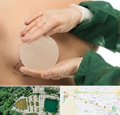 جراحی پروتز سینه در وکیل آباد مشهد