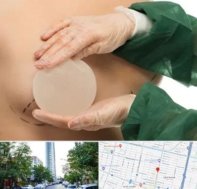 جراحی پروتز سینه در امامت مشهد