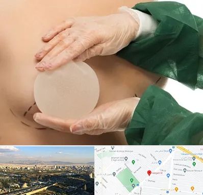 جراحی پروتز سینه در هنگام