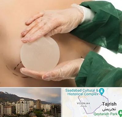 جراحی پروتز سینه در زعفرانیه