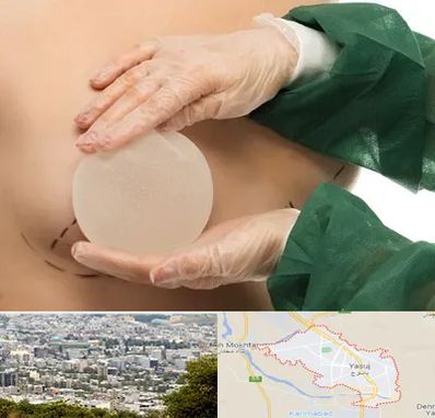 جراحی پروتز سینه در یاسوج
