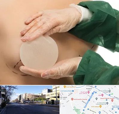 جراحی پروتز سینه در خیابان ملاصدرا شیراز