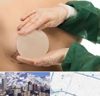 جراحی پروتز سینه در ازگل