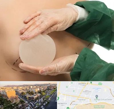 جراحی پروتز سینه در تهرانپارس