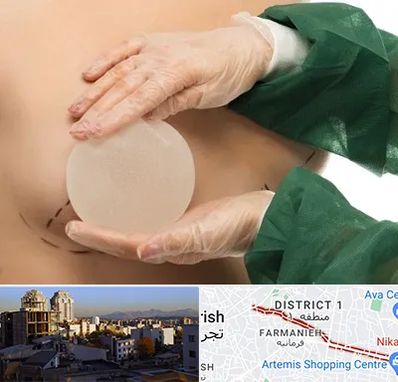 جراحی پروتز سینه در فرمانیه