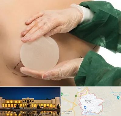 جراحی پروتز سینه در برازجان
