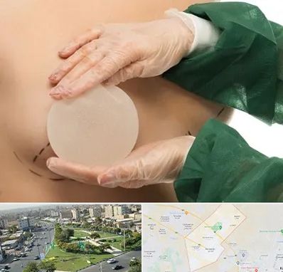 جراحی پروتز سینه در کمال شهر کرج