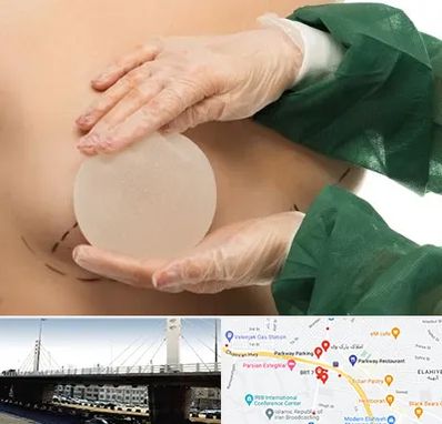 جراحی پروتز سینه در پارک وی