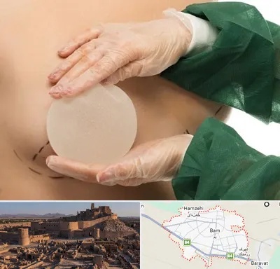 جراحی پروتز سینه در بم