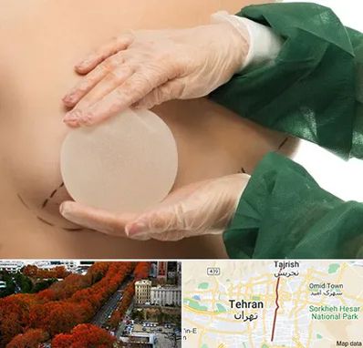 جراحی پروتز سینه در ولیعصر