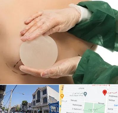 جراحی پروتز سینه در افسریه