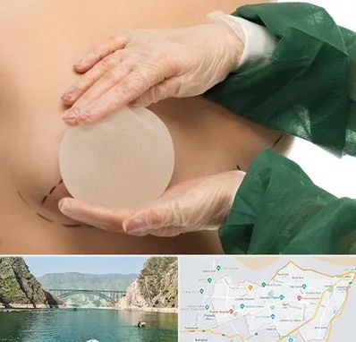 جراحی پروتز سینه در ایلام