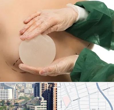 جراحی پروتز سینه در خیابان بهشتی