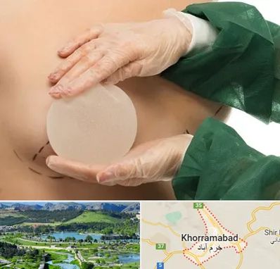 جراحی پروتز سینه در خرم آباد