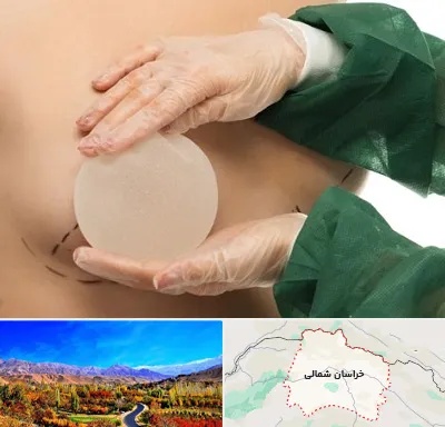 جراحی پروتز سینه در خراسان شمالی