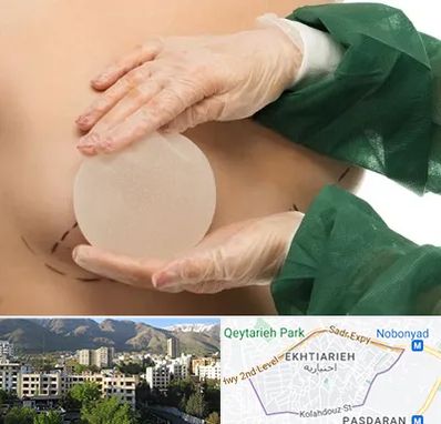 جراحی پروتز سینه در اختیاریه