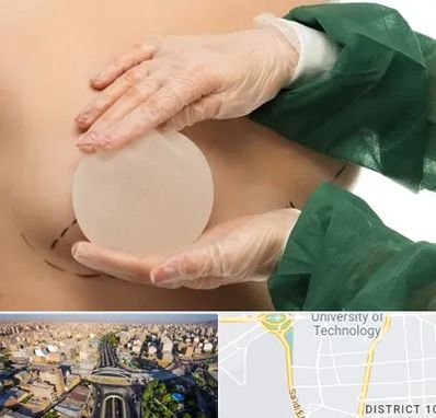 جراحی پروتز سینه در استاد معین