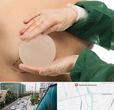 جراحی پروتز سینه در بلوار فرحزادی