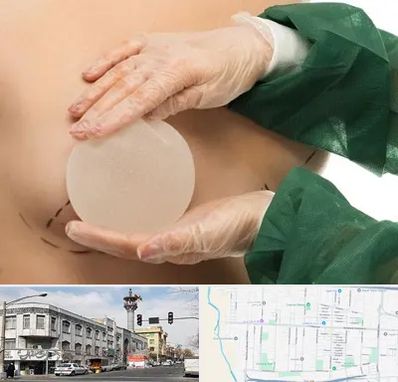 جراحی پروتز سینه در 17شهریور