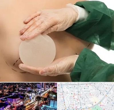 جراحی پروتز سینه در منظریه رشت