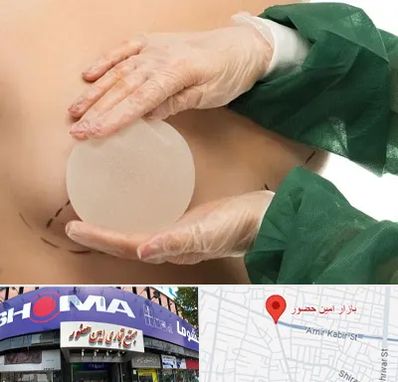 جراحی پروتز سینه در امین حضور