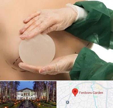 جراحی پروتز سینه در باغ فردوس