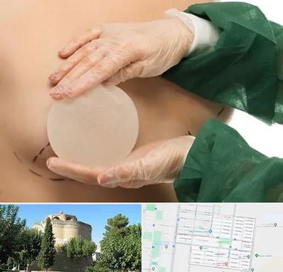 جراحی پروتز سینه در مرداویج اصفهان